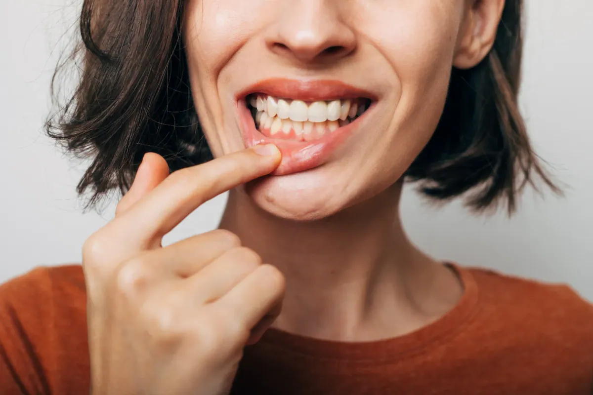 Gum Disease Treatment at Cedar Rapids Smile Center in Cedar Rapids, IA